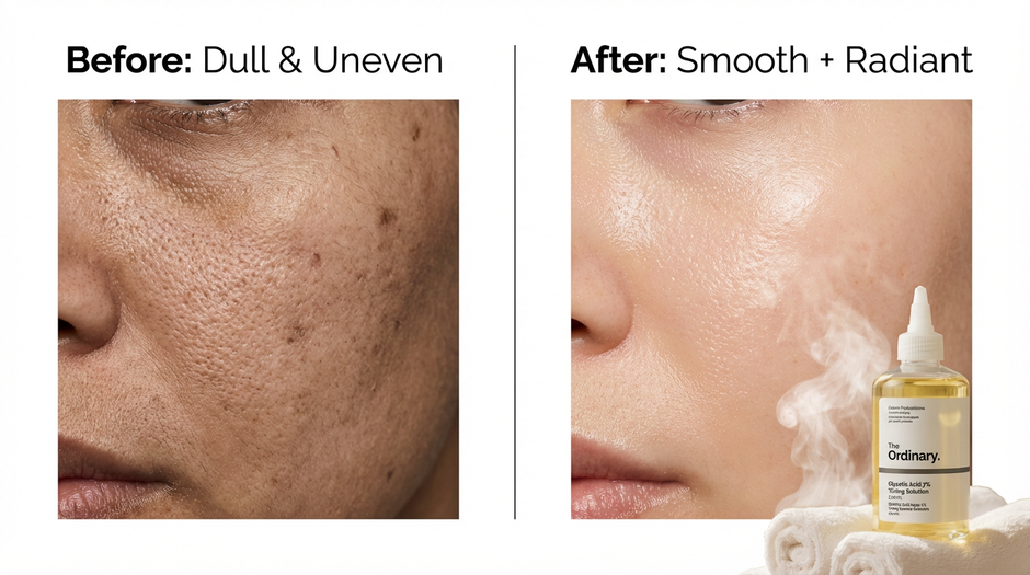 The Ordinary Glycolic Acid 7% Toning Solution - 240 ml